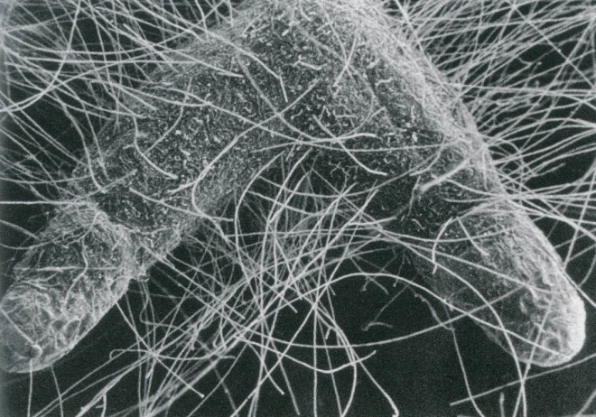 Mycorrhizal fungal filaments (mycelia) radiate into the soil from mycorrhizae-colonized root tips, extending the capacity of the plant’s root system to absorb water and nutrients